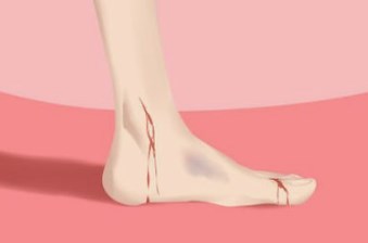 女人脚大意味着什么？这种脚相可能带来什么样命运和特质？